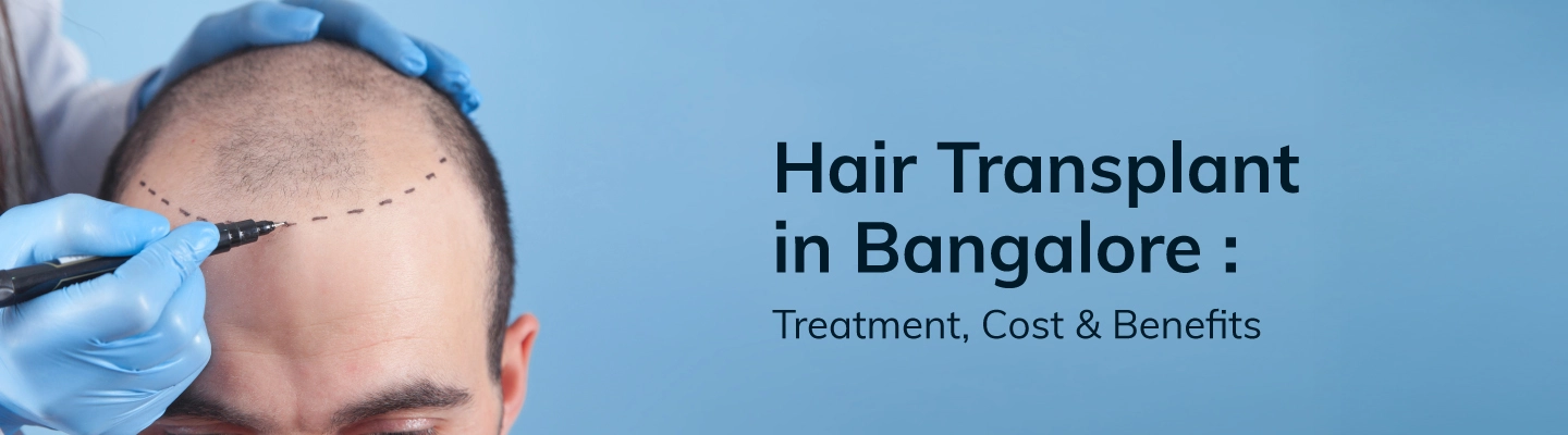 hair transplant in Bangalore 

 

